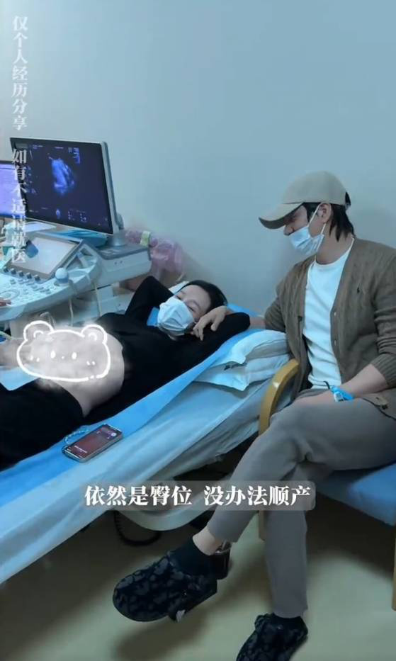 张檬坦言：35周胎儿臀位绕颈，《剖腹产》成必然选择-1